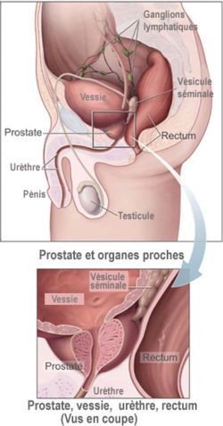 schma de la prostate