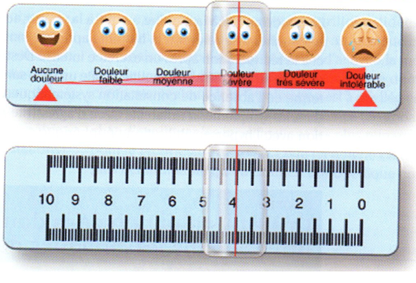 Echelle unidimensionnelle pour évaluer la douleur chez l'homme Echelle unidimensionnelle pour évaluer la douleur chez l'homme